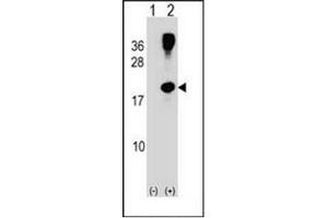 Image no. 1 for anti-Ras Homolog Family Member G (RHOG) (AA 98-128), (C-Term) antibody (ABIN954543)