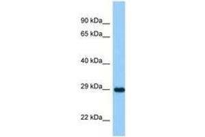 Image no. 1 for anti-Ankyrin Repeat and SOCS Box-Containing 11 (ASB11) (AA 21-70) antibody (ABIN6748270)