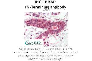 Image no. 1 for anti-BRCA1 Associated Protein (BRAP) antibody (ABIN1732395)