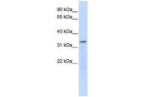 Image no. 1 for anti-Polymerase (RNA) III (DNA Directed) Polypeptide F, 39 KDa (POLR3F) (Middle Region) antibody (ABIN2783472)