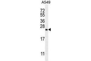 Image no. 3 for anti-Sorting Nexin 24 (SNX24) (AA 21-51), (N-Term) antibody (ABIN954889)