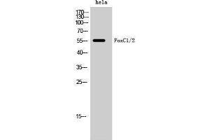 Image no. 1 for anti-Forkhead Box C1 (FOXC1) (Internal Region) antibody (ABIN3184652)