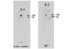 Western blot using  affinity purified anti-ABCB6 antibody (right panel, lane B6) shows detection of Flag tagged human ABCB6 protein at 104 kDa and a truncated form of the protein at 79 kDa (arrowheads).