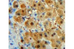 Image no. 3 for anti-Platelet-Derived Growth Factor C (PDGFC) (AA 23-345) antibody (ABIN1860160)