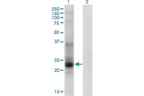 anti-Tetraspanin 8 (TSPAN8) (AA 110-205) antibody