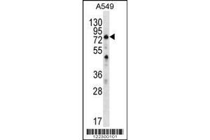 Image no. 1 for anti-Spermatogenesis Associated 7 (SPATA7) (AA 374-401), (C-Term) antibody (ABIN656352)