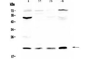 Image no. 1 for anti-Kallikrein 2 (KLK2) (AA 25-261) antibody (ABIN5693006)