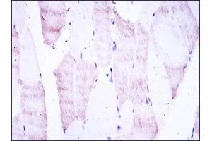 Image no. 3 for anti-Oligodendrocyte Lineage Transcription Factor 2 (OLIG2) antibody (ABIN1845900)