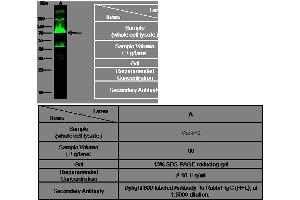 Image no. 3 for anti-Usher Syndrome 1C (Autosomal Recessive, Severe) (USH1C) (AA 1-552) antibody (ABIN1997191)