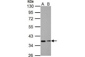 Image no. 1 for anti-Nuclear Factor of kappa Light Polypeptide Gene Enhancer in B-Cells Inhibitor, alpha (NFKBIA) (Center) antibody (ABIN2856763)