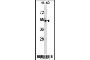 Image no. 3 for anti-Pyruvate Kinase, Liver and RBC (PKLR) (AA 521-551), (C-Term) antibody (ABIN391051)