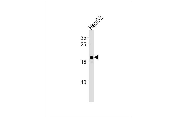 HMGA2 Antikörper  (C-Term)