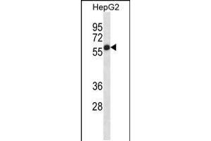 Image no. 2 for anti-Placental Alkaline Phosphatase (ALPP) (AA 56-83), (N-Term) antibody (ABIN5530353)
