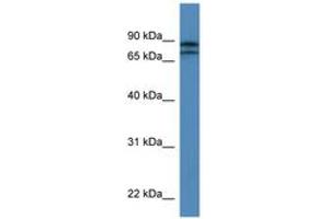 Image no. 1 for anti-Kelch-Like 22 (KLHL22) (AA 175-224) antibody (ABIN6746879)