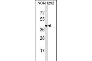 VSIG4 Antikörper  (C-Term)