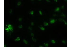 Image no. 1 for anti-alpha-Fetoprotein (AFP) (AA 19-397) antibody (ABIN2716008)