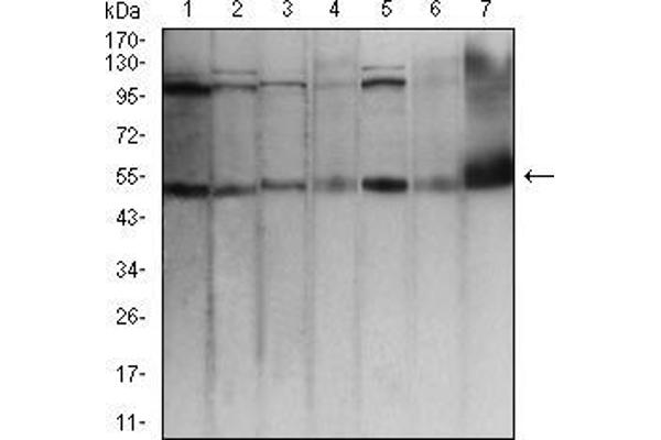 anti-Transcription Factor AP-2 alpha (Activating Enhancer Binding Protein 2 Alpha) (TFAP2A) (AA 1-100) antibody