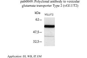 Image no. 1 for anti-Solute Carrier Family 17 (Vesicular Glutamate Transporter), Member 6 (SLC17A6) (C-Term) antibody (ABIN346995)