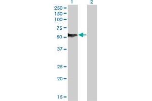 Image no. 4 for anti-Nuclear Factor I/B (NFIB) (AA 1-420) antibody (ABIN518322)