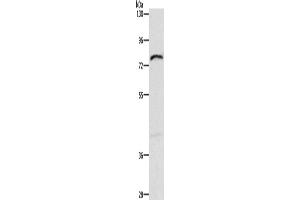 Western blot analysis of Mouse intestinum tenue tissue using XPNPEP1 Polyclonal Antibody at dilution of 1:600