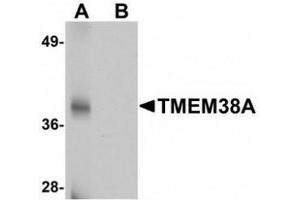 Image no. 2 for anti-Transmembrane Protein 38A (TMEM38A) (C-Term) antibody (ABIN500984)