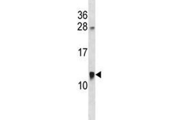 anti-Acyl-CoA Binding Domain Containing 7 (ACBD7) (AA 60-88) antibody