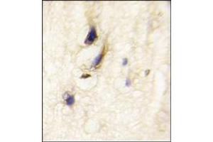 Image no. 1 for anti-Dishevelled Associated Activator of Morphogenesis 1 (DAAM1) (C-Term), (N-Term) antibody (ABIN357856)
