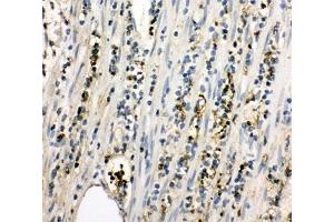 Image no. 2 for anti-Linker For Activation of T Cells (LAT) (C-Term) antibody (ABIN3031630)