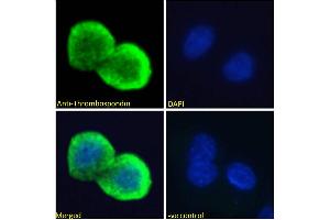 Image no. 3 for anti-Thrombospondin 1 (THBS1) (N-Term) antibody (ABIN1781811)