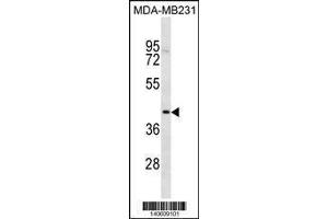 anti-TOX High Mobility Group Box Family Member 2 (TOX2) (AA 286-312) antibody