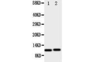 Image no. 1 for anti-Chemokine (C-X-C Motif) Ligand 1 (Melanoma Growth Stimulating Activity, Alpha) (CXCL1) (AA 99-107), (C-Term) antibody (ABIN3044150)