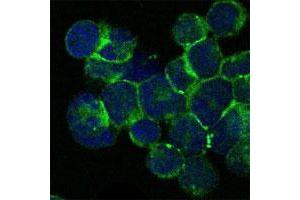 Image no. 1 for anti-IL2-Inducible T-Cell Kinase (ITK) antibody (ABIN5581306)
