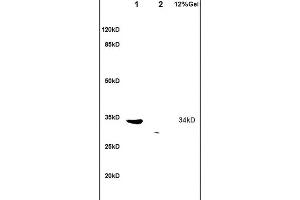 Image no. 2 for anti-TNFRSF1A-Associated Via Death Domain (TRADD) (AA 111-230) antibody (ABIN673314)