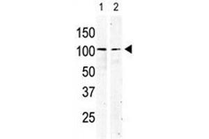 Image no. 5 for anti-Mast/stem Cell Growth Factor Receptor (KIT) (AA 9-40) antibody (ABIN3028571)