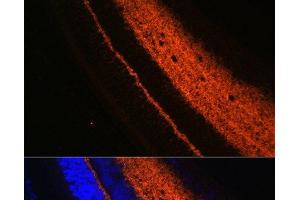 Immunofluorescence analysis of Rat eye using SYT1 Polyclonal Antibody at dilution of 1:100 (40x lens).