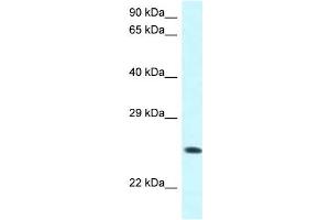Image no. 1 for anti-WW Domain Containing Oxidoreductase (WWOX) (C-Term) antibody (ABIN2788787)