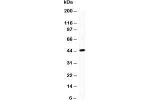 Image no. 1 for anti-Activating Transcription Factor 2 (ATF2) (AA 93-450) antibody (ABIN3029845)