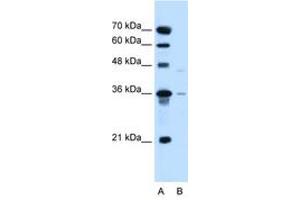 Image no. 1 for anti-Solute Carrier Family 17 (Anion/Sugar Transporter), Member 3 (SLC17A3) (AA 171-220) antibody (ABIN6736633)