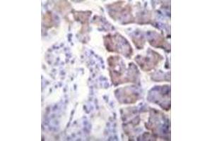 Image no. 2 for anti-Carboxypeptidase B1 (Tissue) (CPB1) (AA 16-45), (N-Term) antibody (ABIN951034)
