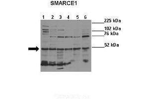 Image no. 3 for anti-SWI/SNF Related, Matrix Associated, Actin Dependent Regulator of Chromatin, Subfamily E, Member 1 (SMARCE1) (N-Term) antibody (ABIN2780465)