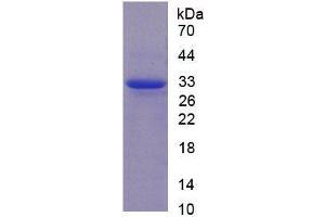 Image no. 1 for Calpain 1, Large Subunit (CAPNL1) (AA 75-356) (Active) protein (His tag) (ABIN6239882)