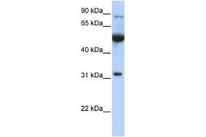Image no. 2 for anti-Eukaryotic Translation Initiation Factor 2B, Subunit 1 Alpha, 26kDa (EIF2B1) (C-Term) antibody (ABIN2784713)