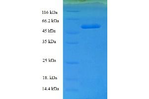 General Transcription Factor IIB (GTF2B) (AA 1-316), (full length) protein (His-SUMO Tag)