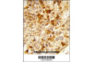 Image no. 2 for anti-Peroxisomal Biogenesis Factor 2 (PEX2) (AA 165-194) antibody (ABIN653126)