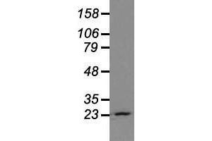 Image no. 1 for anti-Neurogenin 1 (NEUROG1) antibody (ABIN1499703)