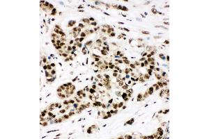 Image no. 6 for anti-X-Ray Repair Complementing Defective Repair in Chinese Hamster Cells 5 (Double-Strand-Break Rejoining) (XRCC5) (AA 648-662), (C-Term) antibody (ABIN3044235)