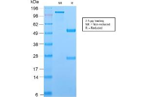 Image no. 1 for anti-T-Cell Leukemia/lymphoma 1A (TCL1A) (AA 2-109) antibody (ABIN6940950)