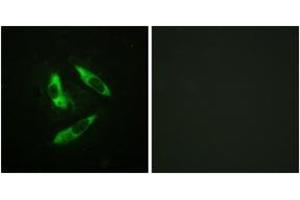 Immunofluorescence analysis of HeLa cells, using Rabphilin 3A (Phospho-Ser237) Antibody.