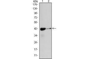 Image no. 4 for anti-Actin, alpha 2, Smooth Muscle, Aorta (ACTA2) antibody (ABIN968946)