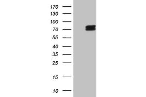 Image no. 1 for anti-Aminolevulinate, delta-, Synthase 1 (ALAS1) (AA 57-308) antibody (ABIN2715863)